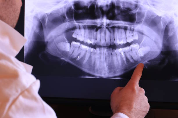 Best Broken or Cracked Tooth Emergency Dentist in New York Mills, NY