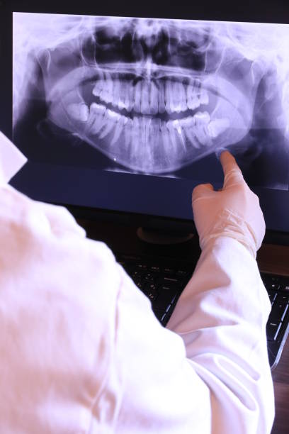 Best Emergency Dentist for Lost Fillings or Crowns in New York Mills, NY